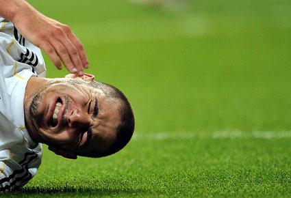 نجوم ريال مدريد يتألمون